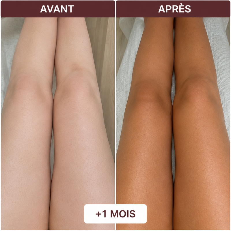Justine K. — avant / après
